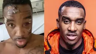 Bugzy Malone Speaks Out Since Motorbike Crash
