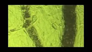 2 Minute BEMER Enhanced Blood Flow Video Narrated by Dr. Joshua Berka
