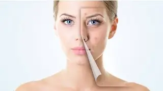 How to wash 🌊your face  with salt water with warning ⚠️.#beauty