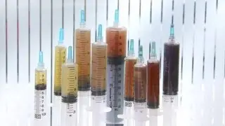 Hip Replacement Metallosis