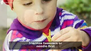 Top 5 Steps to Safely Remove Your Child&rsquo;s Splinter