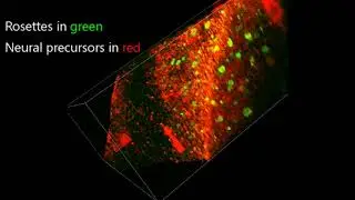 Neural rosettes in autism spheroids (in 3D)