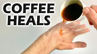 How Coffee Affects Healing? (INCREDIBLE)