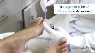 Tratamento de micose de unha