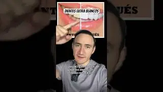 &iquest;Se pueden blanquear los dientes sin verse falsos?