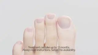 How to treat Nail fungal infections Nailner | #1 Nail Fungus Treatment | Easy To Use