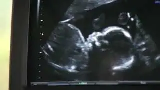 Florida Hospital Tampa Bay Division TV ad -- Maternity