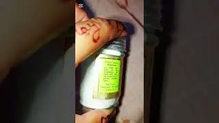 #viralvedio2025 #skincareproducts #skinbrightening #bestfacecream#latestvedio2025 #reviewtibetcream