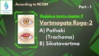 Shalakya ch 9 Vartmagata Roga-2 A) Pothaki (Trachoma) B) Sikatavartma #bams3rdprof #ncism 