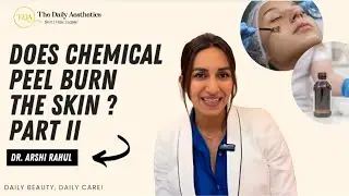 Does Chemical peel burn the skin? Part 2 Dr. Arshi Rahul - Anti-Aging Expert The Daily Aesthetics