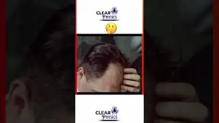 WORLD FIRST HUMAN HAIR GROWING TECHNOLOGY. #hairgrowth #baldness #scientist #technology #tech