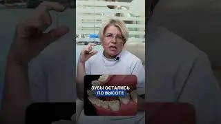 Чем раньше вылечите зубы, тем лучше #стоматология #андрейжук #ортолайк
