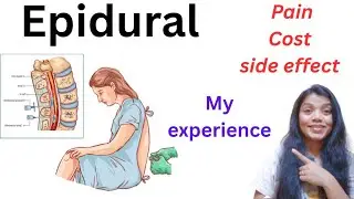 Epidural injection in pregnancy/My experience with Epidural injection for normal delivery/Pregnancy 