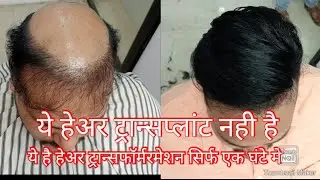 s&g hair fixing studio in Aurangabad, jalna, beed, buldana, parbhani, nanded, call now 7887622535..