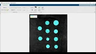 Coin Detection and Count in MATLAB | Valid & Invalid Coins detection