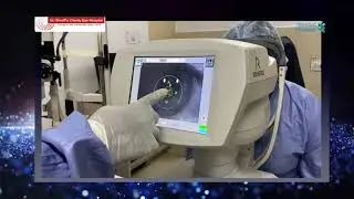 CLINICAL SPECULAR MICROSCOPY
