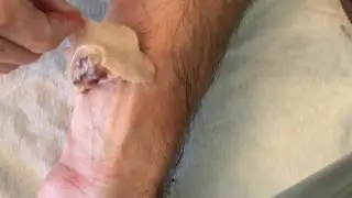 Натуральный спирт для удаления десен с помощью этого ежедневного средства