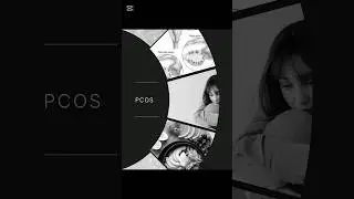 Polycystic ovarian syndrome #pcos #pcosrelief #pcosawareness #health #womenissues