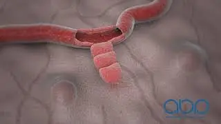 Blood Vessels Regenerating -  3D Medical Animation || ABP &copy;