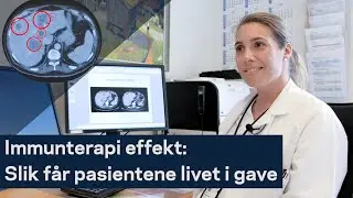 R&oslash;ntgenbilder: Effekten av immunterapi
