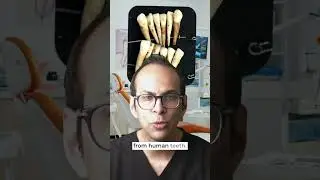 false teeth weren't always fake! #shorts #smilemakeover #dentistuk #cosmeticdentists