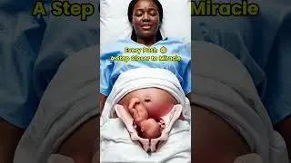 Moment of Birth👶The Final Miracle of Life #miracleinmotion #EducationalShorts #baby
