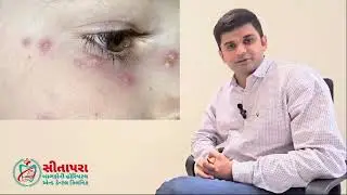 Healthy children happy family video series episode- 23અછબડા નો રોગ શું છે? તેને કઈ રીતે અટકાવી શકાય?