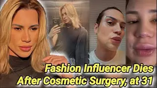 Adair Mendes Dutra Junior Dead at 31 | Brazil Influencer Dies After Fox Eyes Cosmetic Surgery | Died