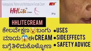 HHlite Cream Review in kannada|Uses|side effects| #melasma #hyperpigmentation #pigmentation#viral