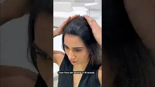 Cover Front Hair Thinning in 10 Seconds | Flattest Hair Patch For Hair Loss