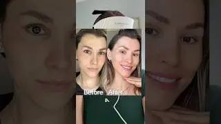 Как я преобразила свою кожу с помощью светодиодной терапии! 😌✨ #советыпокрасоте #маскаwavytalk #с...