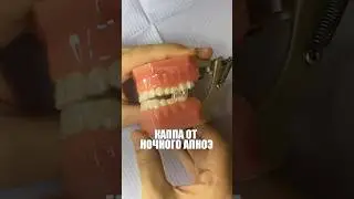 Каппа от остановок дыхания во сне (ночное апноэ) #гнатолог #апноэ #здоровьесна