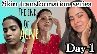 Skin transformation series - day-1! Ance and pimples removal from face, #shorts #trending #skincare