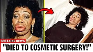 15 Beautiful Black R&B Singers Who Tragically Died from Cosmetic Surgery &mdash; Then and Now 2025