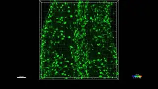 Migrating interneuron precursors in the cerebellum