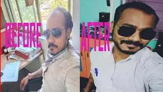My Hair Transformation | Hair Regrowth Story | Hair Baldness Problem | Hair Fall Solutions