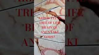 ARBOR VITAE TREE OF LIFE BRAIN OF ANUNNAKI GODS?