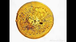 Inside the Testate amoeba