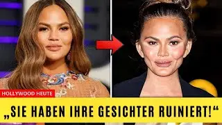 7 Hollywood-Stars, Deren Gesicht Durch Buccal Fat Removal Entstellt Wurde | Vorher & Nachher 2025