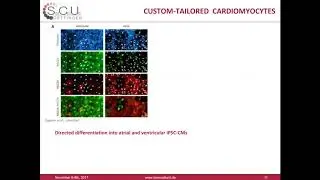 Differentiation of human pluripotent stem cells into atrial and ventricular cardiomyocyte subtypes