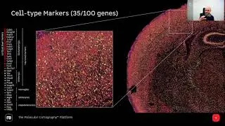 Oxford Global - Spatial Biology US Online Workshop - Resolve Biosciences