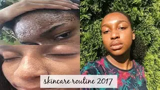 HOW I CLEARED MY SKIN! (Skincare Routine) | Coco Chinelo