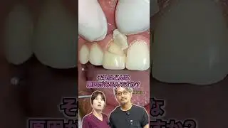 セラミックが割れる#shorts