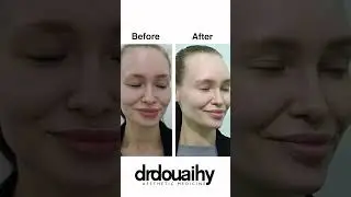 Quiet Luxury Starts With Your Face