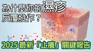 濕疹無法根治？2025 最新治療趨勢：告別類固醇，找出「止癢」與「斷根」的關鍵 (生物製劑/JAK)&nbsp;| EssenceOfInfo 資訊精髓