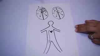 Atrial Fibrillation ablation