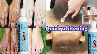 Primigo D-Tan Whitening Gel Review | Remove Tan |Dark Spots | Get Soft Skin | Honest Review @Meesho 