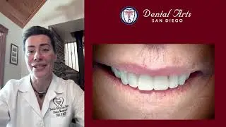 Complete Dental Transformation