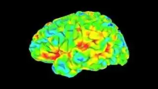 'Resting state' brain scans give diagnosis by default