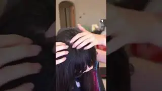 Эмиру лысеет